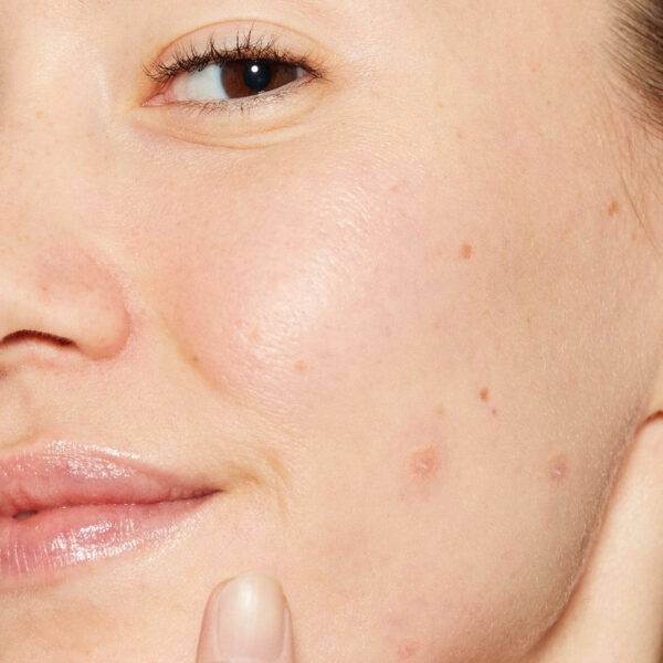 Zarania Clearing Skin Wash - Purifying & Acne-Fighting Face Cleanser - Image 3