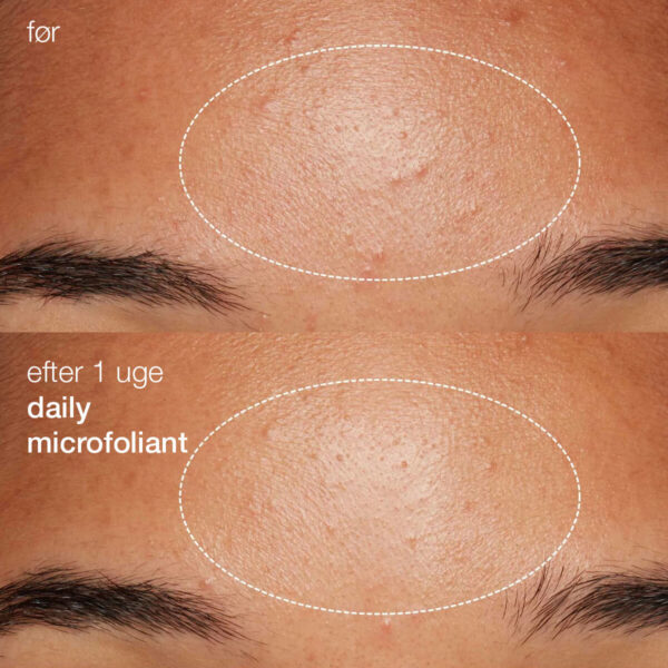 Zarania Daily Microfoliant - Gentle Exfoliating & Smoothing Powder - Image 3